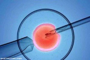 关于青碧生殖